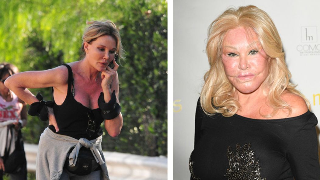 Jocelyn Wildenstein