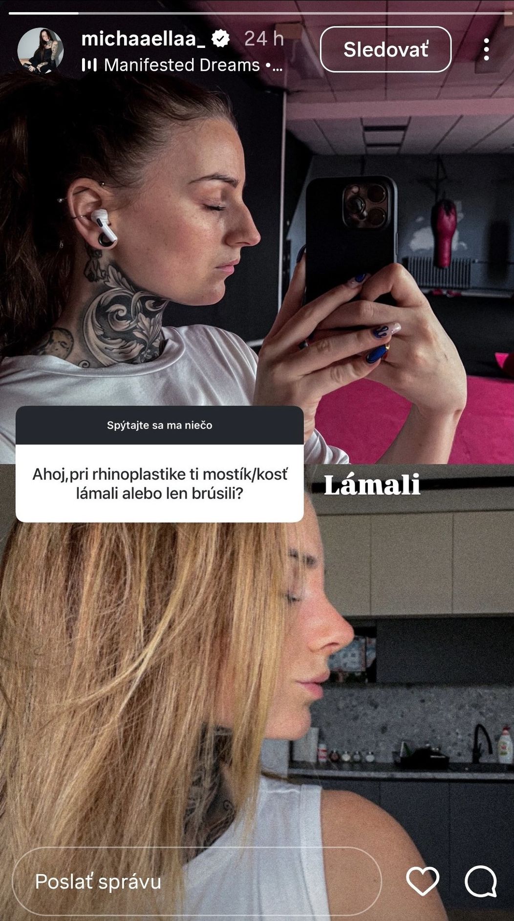 Miška z Love Islandu ukázala záber po plastike nosu.