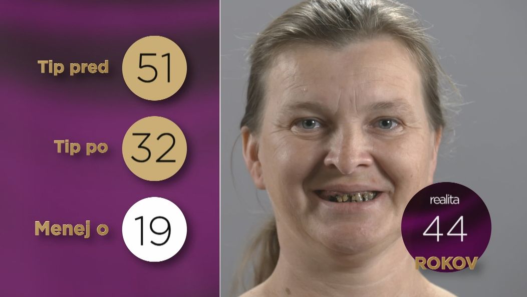 Zdenka pred premenou