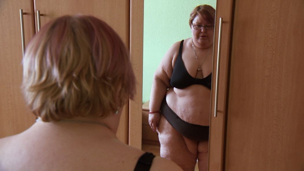 Silvii skrachoval vzťah aj kvôli extrémnej obezite