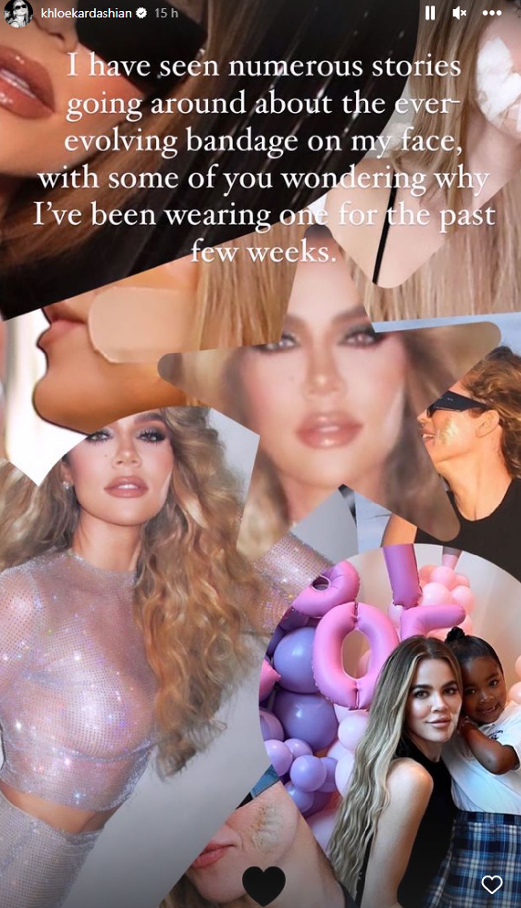 Khloé Kardashian 