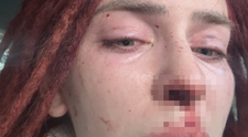 Prípad týranej influencerky Ráchel už rieši generálny prokurátor