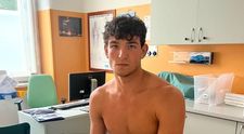 Zbyněk z Love Islandu po návrate z Thajska. Keď lekár hrôzu uvidel, okamžite zasiahol