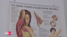 Európsky priemer presahujeme o viac ako 20 %