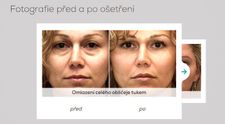 Štyri dôvody prečo vycestovať za krásou a mladším vzhľadom do Prahy