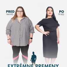 Dominika Kubičková v šou Extrémne premeny Slovensko: Druhá šanca na život (pred a po)