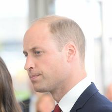 Princ William má nad ľavým obočím jazvu