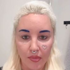 Amanda Bynes po operácii