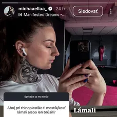 Miška z Love Islandu ukázala záber po plastike nosu.