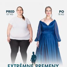 Kamila Zemančíková v šou Extrémne premeny Slovensko - Druhá šanca na život (Pred a Po)