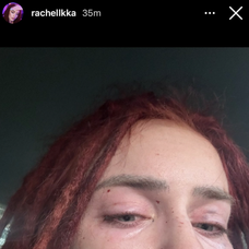 Ráchel Karnižová zverejnila fotky po bitke a správy plné vulgarizmov