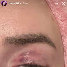 Ráchel Karnižová zverejnila fotky po bitke a správy plné vulgarizmov