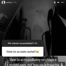 Tereza Kosecová zverejnila fotky po bitke