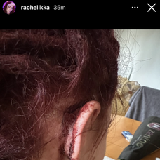 Ráchel Karnižová zverejnila fotky po bitke a správy plné vulgarizmov