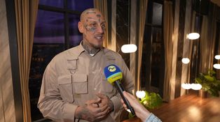 Separ prehovoril o svojom nízkom EQ