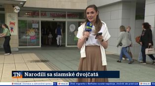 Narodili sa siamské dvojčatá