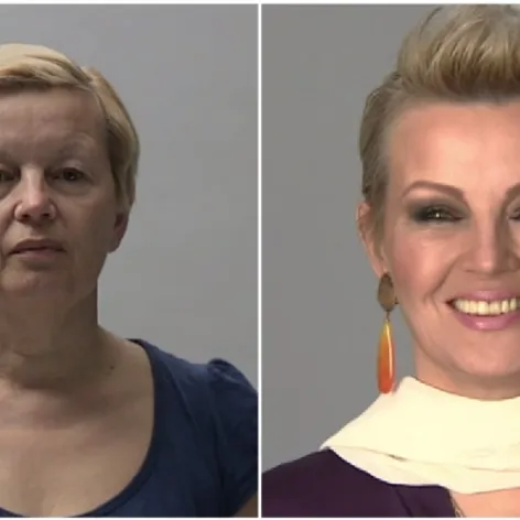 Blažena pred premenou a po nej