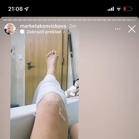 Markéta mala nepríjemné zranenie