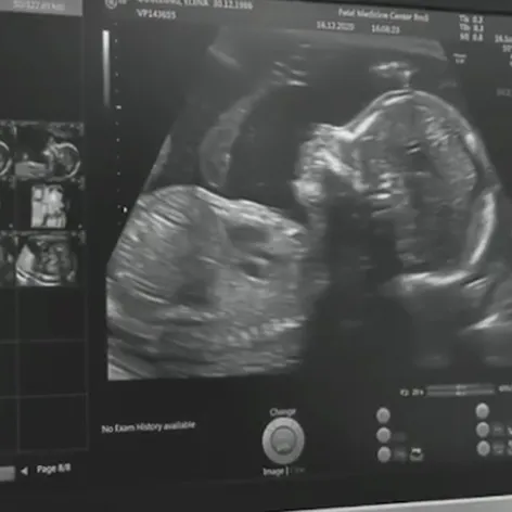 Zábery z videa Ellie Goulding