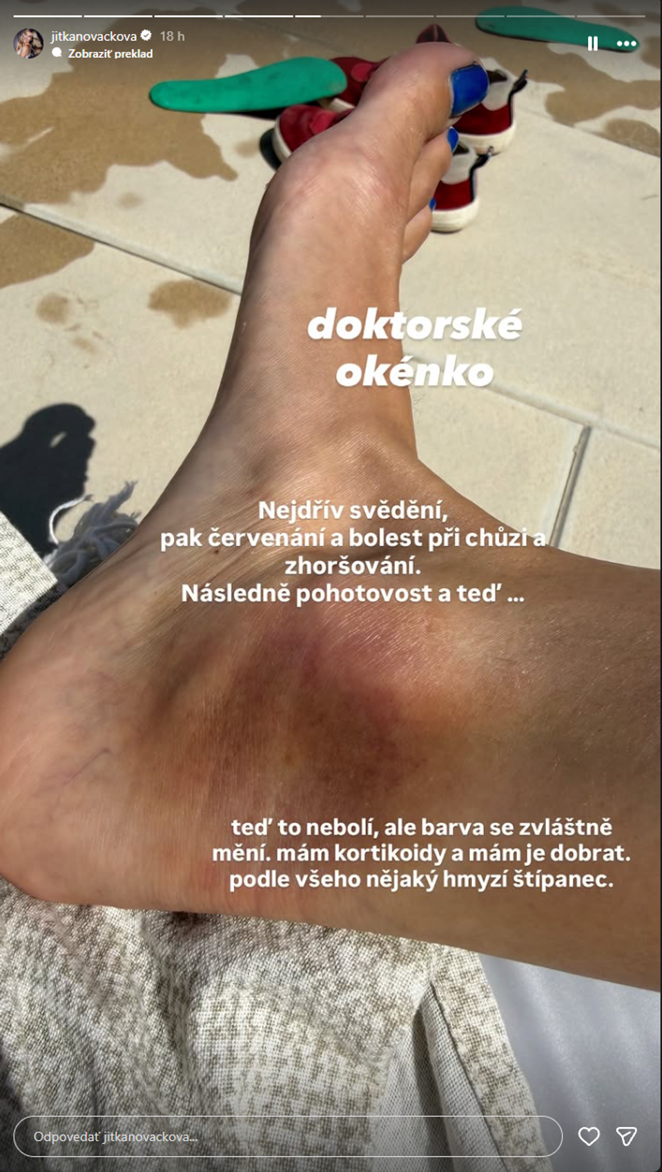 Modelka Jitka Nováčková 