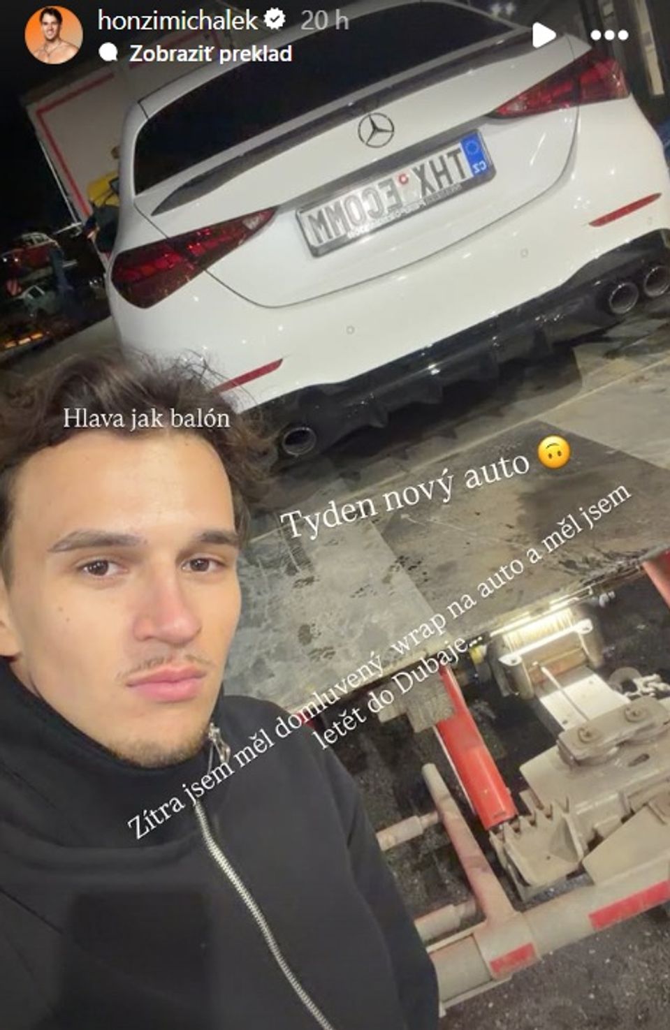 Love Island - Honza a Patrície mali nehodu
