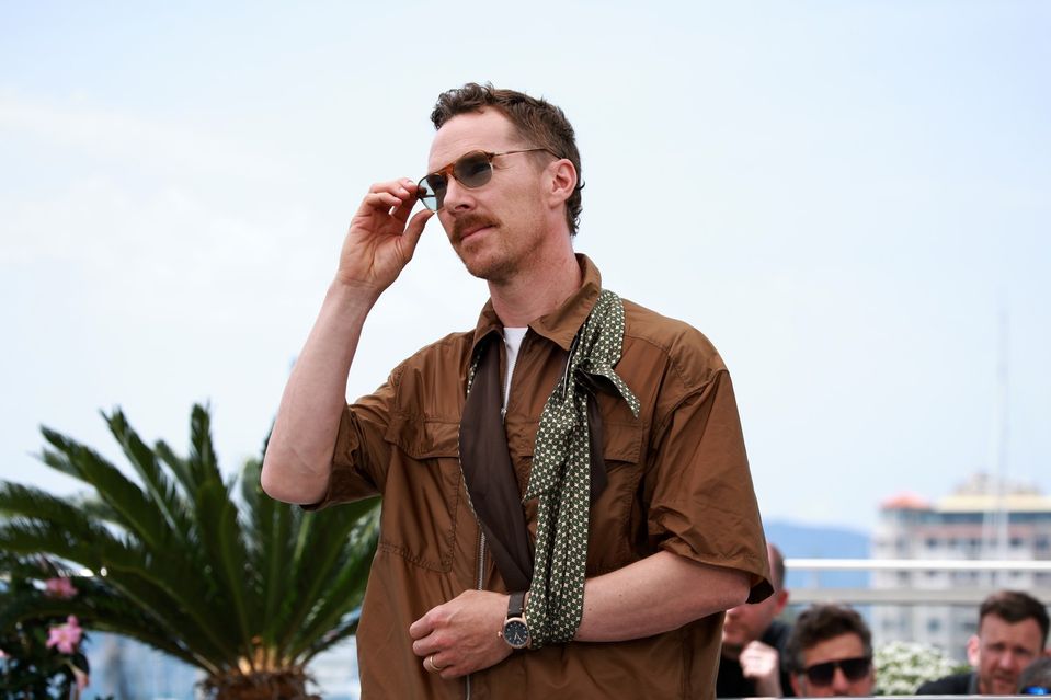 Benedict Cumberbatch s poranenou rukou