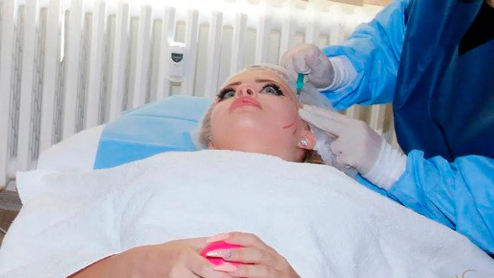 Zábery pre odolných: Česká Barbie podstúpila nepríjemný zákrok