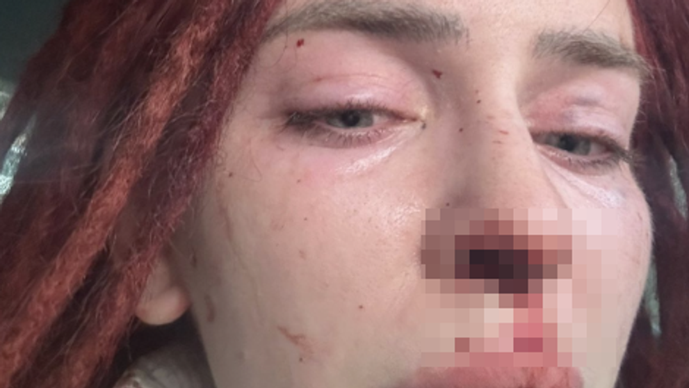 Prípad týranej influencerky Ráchel už rieši generálny prokurátor