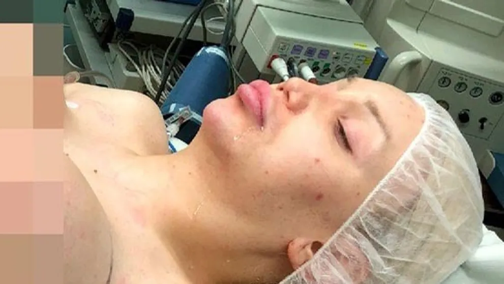 Drobné telo modelky neustálo obrie implantáty. Akútna operácia