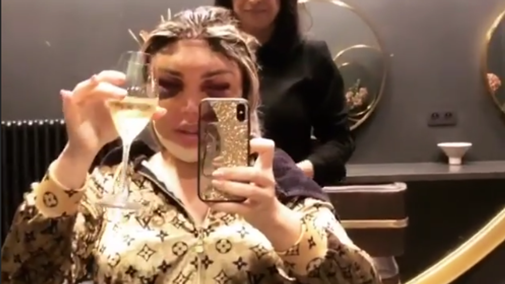 Len pre silné žalúdky: Najznámejší Ken je po drastickom zákroku Barbie