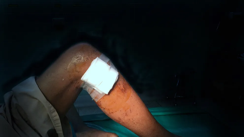 Doteraz ste to videli len vo filme. Gél zocelí ranu za 60 sekúnd