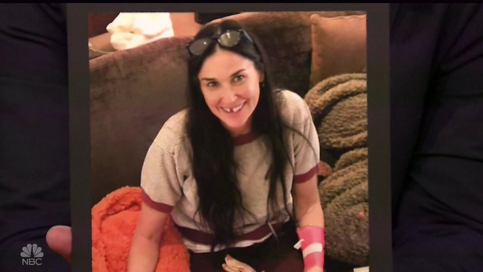 Demi Moore prišla o predné zuby. Môže za to choroba