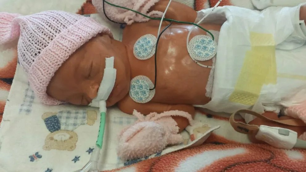 Predčasne narodená Alžbetka boj o život vyhrala. Stále však potrebuje pomoc