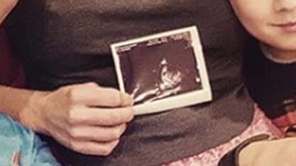 Babyboom sa neskončil! Ďalší známy pár je v očakávaní