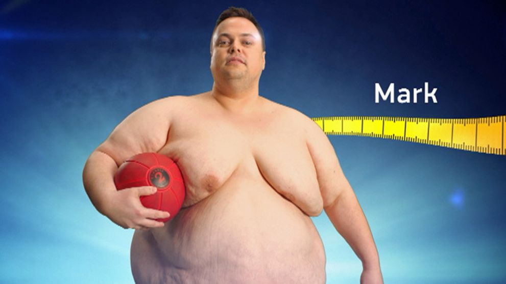 Srdce ako v perinke? Toto spôsobí 107 kilogramov tuku!