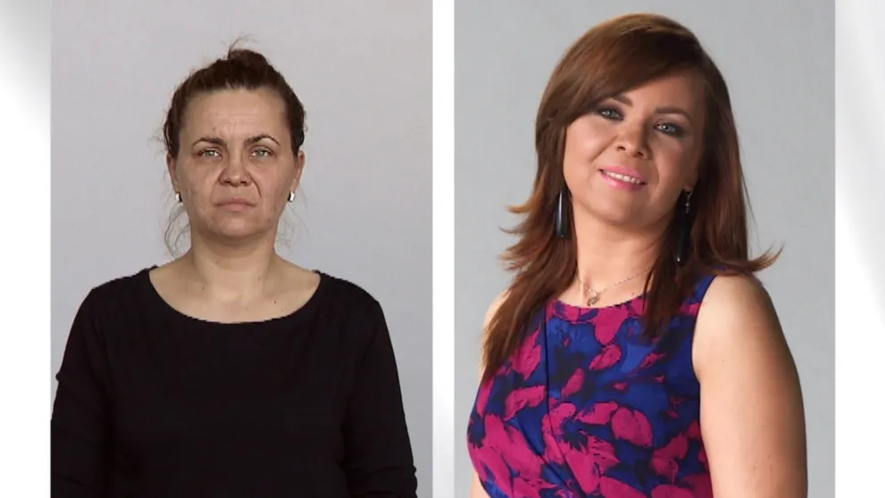 Opravené zuby, zlepšený zrak: Toto je výsledok štvrtej nádhernej premeny!
