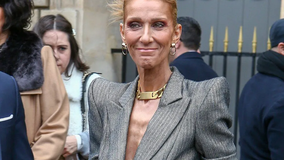 Céline Dion vystrašila fanúšikov. Nevyzerá zdravo