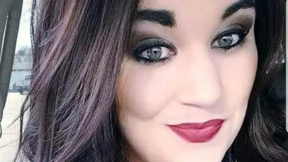 Mladej mamičke spálila kulma polku tváre: Nebyť malej dcérky, dopadla by ešte horšie