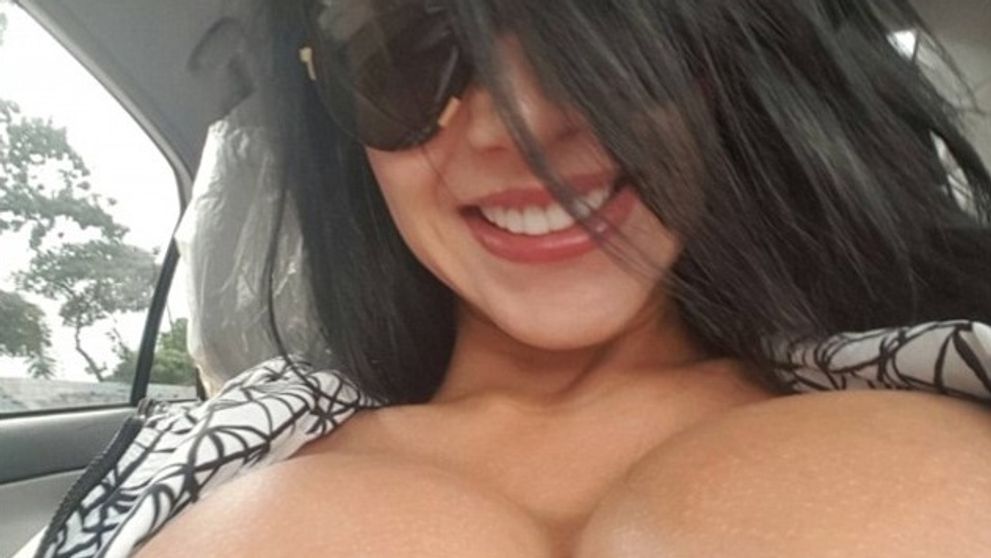 Modelka posadnutá plastikami odporúča ženám, aby vyzerali ako ona