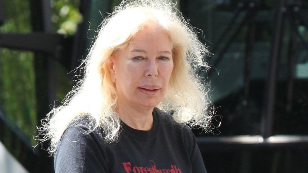 Krásna sestra zo seriálu M*A*S*H sa zmenila na plastikovú kreatúru