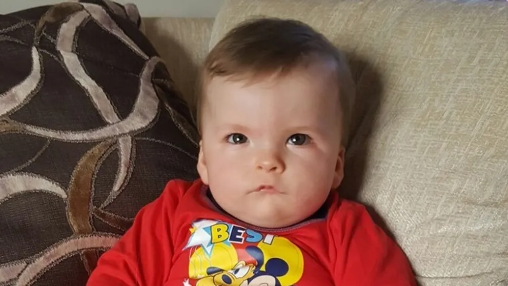 Tento chlapec sa nikdy neusmeje. Trpí vzácnou chorobou