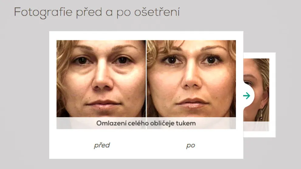 Štyri dôvody prečo vycestovať za krásou a mladším vzhľadom do Prahy
