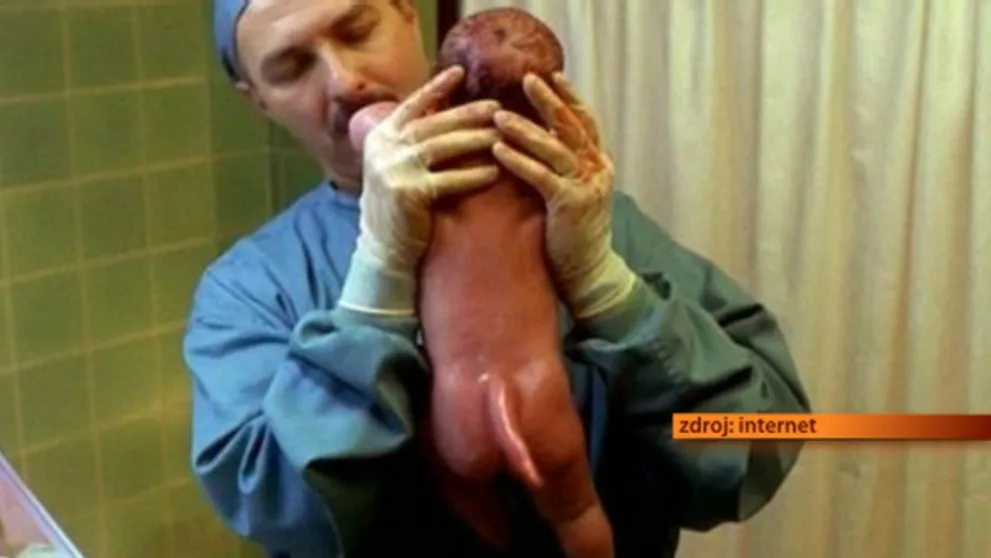 Ľudia s chvostom